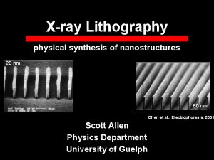 Xray Lithography physical synthesis of nanostructures 20 nm