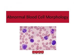 Abnormal Blood Cell Morphology Abnormal White Blood Cells