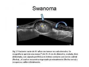 Swanoma Fig 27 Paciente varn de 80 aos