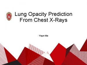 Lung Opacity Prediction From Chest XRays Yiqun Ma