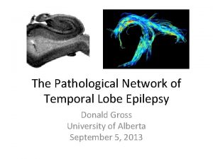 The Pathological Network of Temporal Lobe Epilepsy Donald