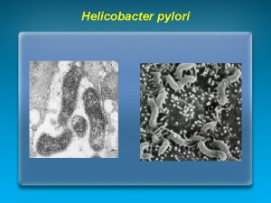 Helicobacter pylori Il fattore patogenetico principale dellulcera gastrica