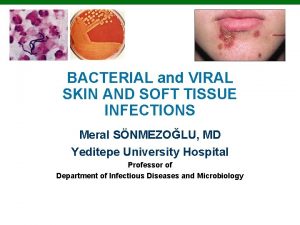 BACTERIAL and VIRAL SKIN AND SOFT TISSUE INFECTIONS