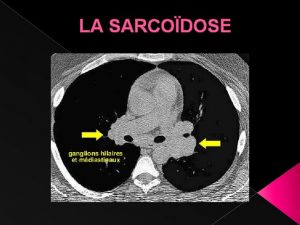 Sarcodose