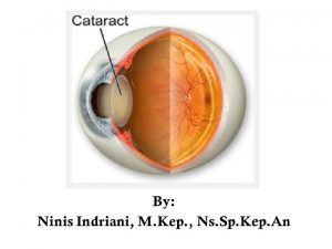 Anatomi lensa