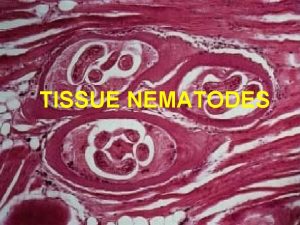 TISSUE NEMATODES COMMON TISSUE NEMATODE INFECTIONS Trichinella spiralis