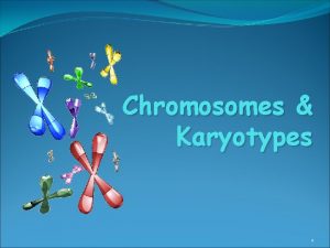 Chromosomes Karyotypes 1 Chromosomes 2 Chromosome Number All