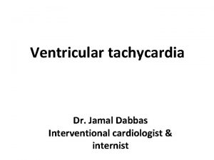 Ventricular tachycardia Dr Jamal Dabbas Interventional cardiologist internist