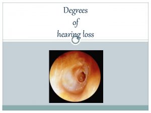 Degrees of hearing loss Determining the Hearing Loss