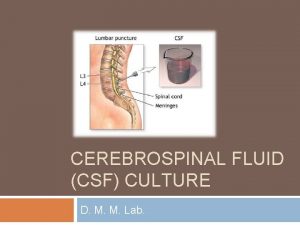 CEREBROSPINAL FLUID CSF CULTURE D M M Lab