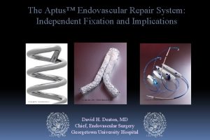 The Aptus Endovascular Repair System Independent Fixation and