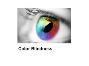Color Blindness How the Eye Works Rods located