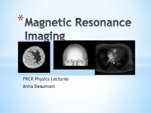 FRCR Physics Lectures Anna Beaumont Aspect of image