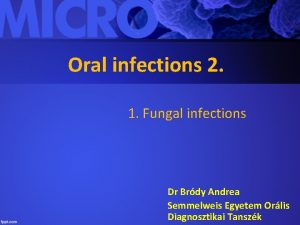 Oral infections 2 1 Fungal infections Dr Brdy