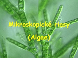 Mikroskopick riasy Algae Charakteristika rastlinn jednobunkovce tvoria ru