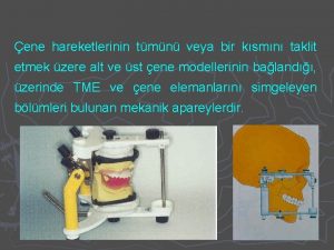 Posselt diyagramı nedir