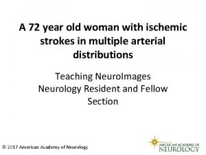 A 72 year old woman with ischemic strokes