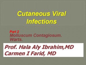 Cutaneous Viral Infections Part 2 Molluscum Contagiosum Warts