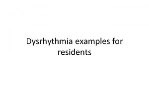 Dysrhythmia examples for residents When analyzing a tachycardia