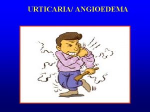 Chronic inducible urticaria