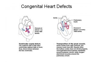 Congenital Heart Defects Congenital Heart Defects Congenital Heart
