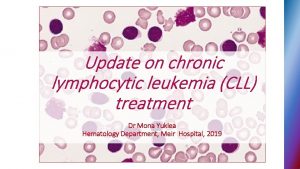 Update on chronic lymphocytic leukemia CLL treatment Dr