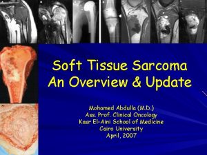 Soft Tissue Sarcoma An Overview Update Mohamed Abdulla