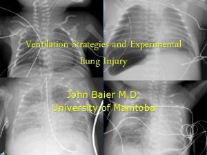 Ventilation Strategies and Experimental Lung Injury John Baier