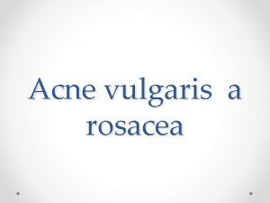 Acne vulgaris a rosacea Acne vulgaris chronick zntliv