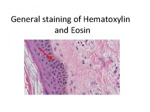 General staining of Hematoxylin and Eosin Ionic bonding