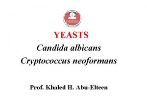 YEASTS Candida albicans Cryptococcus neoformans Prof Khaled H