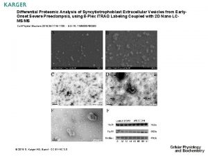 Differential Proteomic Analysis of Syncytiotrophoblast Extracellular Vesicles from