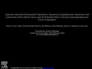 HypoxiaInducible Erythropoietin Signaling in Squamous Dysplasia and Squamous