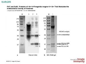 FAF and Suf A Proteins of biFinegoldia magnaib