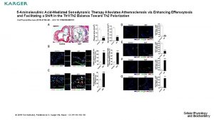 5 Aminolevulinic AcidMediated Sonodynamic Therapy Alleviates Atherosclerosis via