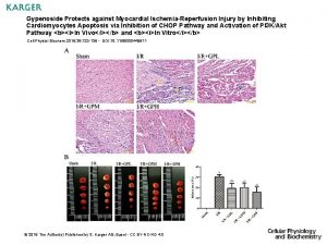 Gypenoside Protects against Myocardial IschemiaReperfusion Injury by Inhibiting