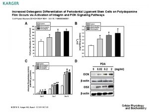 Increased Osteogenic Differentiation of Periodontal Ligament Stem Cells