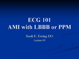 ECG 101 AMI with LBBB or PPM Scott