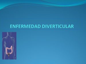 ENFERMEDAD DIVERTICULAR Diverticulosis colonica Condicin adquirida que resulta