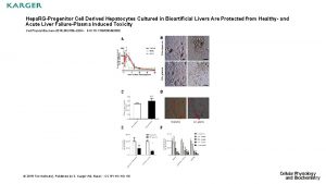 Hepa RGProgenitor Cell Derived Hepatocytes Cultured in Bioartificial