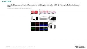 Lipocalin 2 Suppresses Ocular Inflammation by Inhibiting the