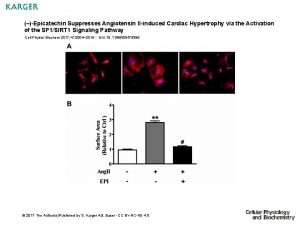 Epicatechin Suppresses Angiotensin IIinduced Cardiac Hypertrophy via the