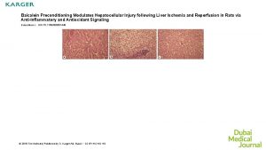 Baicalein Preconditioning Modulates Hepatocellular Injury following Liver Ischemia