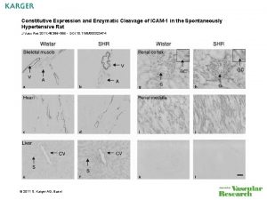 Constitutive Expression and Enzymatic Cleavage of ICAM1 in