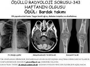 DLL RADYOLOJ SORUSU343 HAFTANIN OLGUSU DL Bardak takm