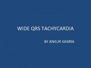 WIDE QRS TACHYCARDIA BY ANKUR KAMRA Wide QRS