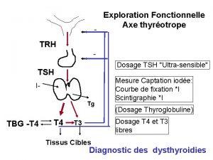 Exploration Fonctionnelle Axe thyrotrope TRH Dosage TSH Ultrasensible