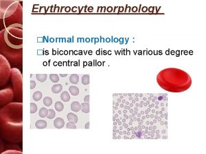 Erythrocyte morphology Normal morphology is biconcave disc with