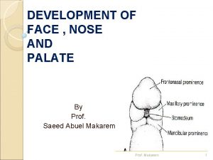 DEVELOPMENT OF FACE NOSE AND PALATE By Prof