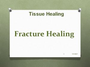 Tissue Healing Fracture Healing 1 932021 Bellwork Take